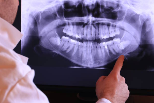 Best Dental Abscess Treatment in Hebron Estates, KY