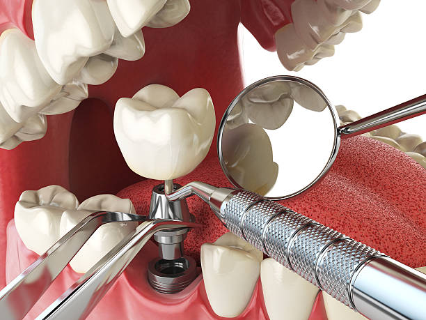 Professional Emergency Dental Service in KY