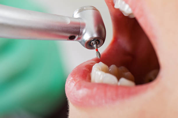 Best Emergency Dental Care for Sports Injuries in Hebron Estates, KY